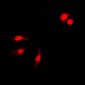 Anti-NF-kappaB p105 (pS927) Antibody